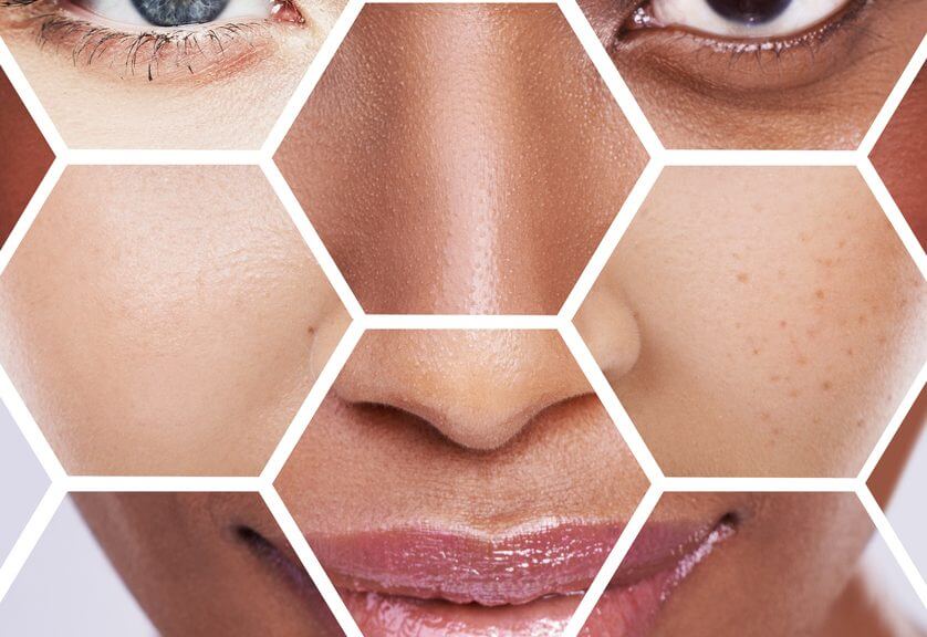 Essential Oil Daily Routines to Help Oily Skin