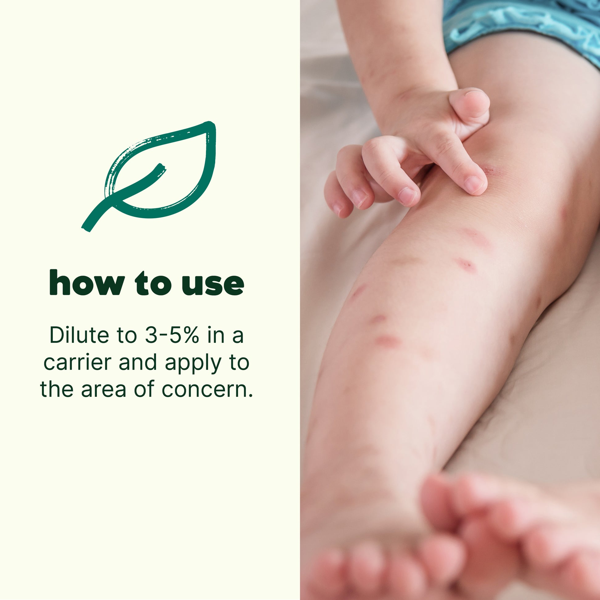 Itch Away Essential Oil